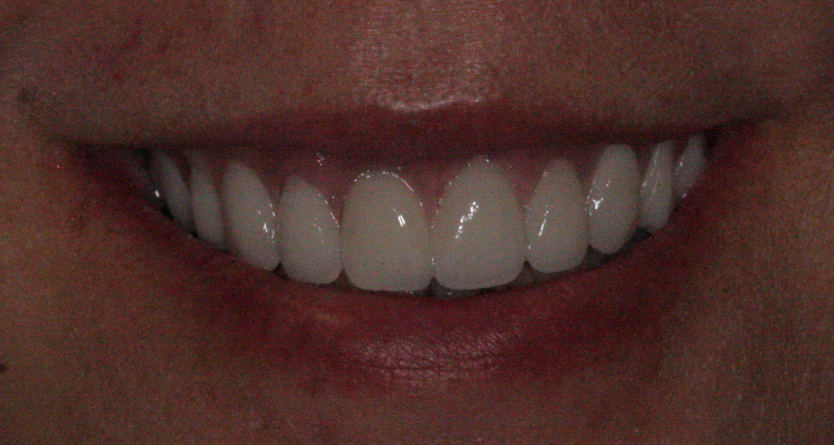 Bright white smile close-up