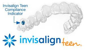 Invisalign Teen aligner with compliance indicator