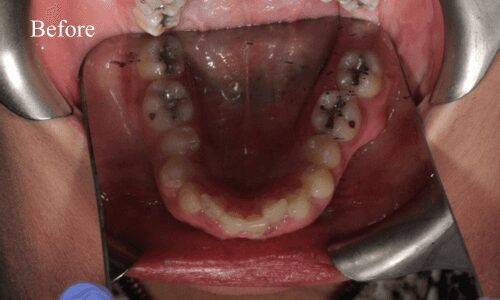 Dental examination with mouth open
