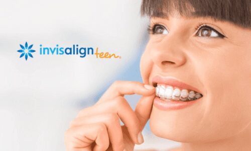 Teen smiling with clear aligners