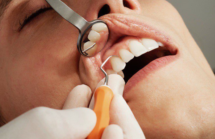 Oral health examination at clinic