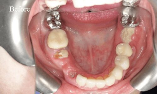 Open mouth with dental issues